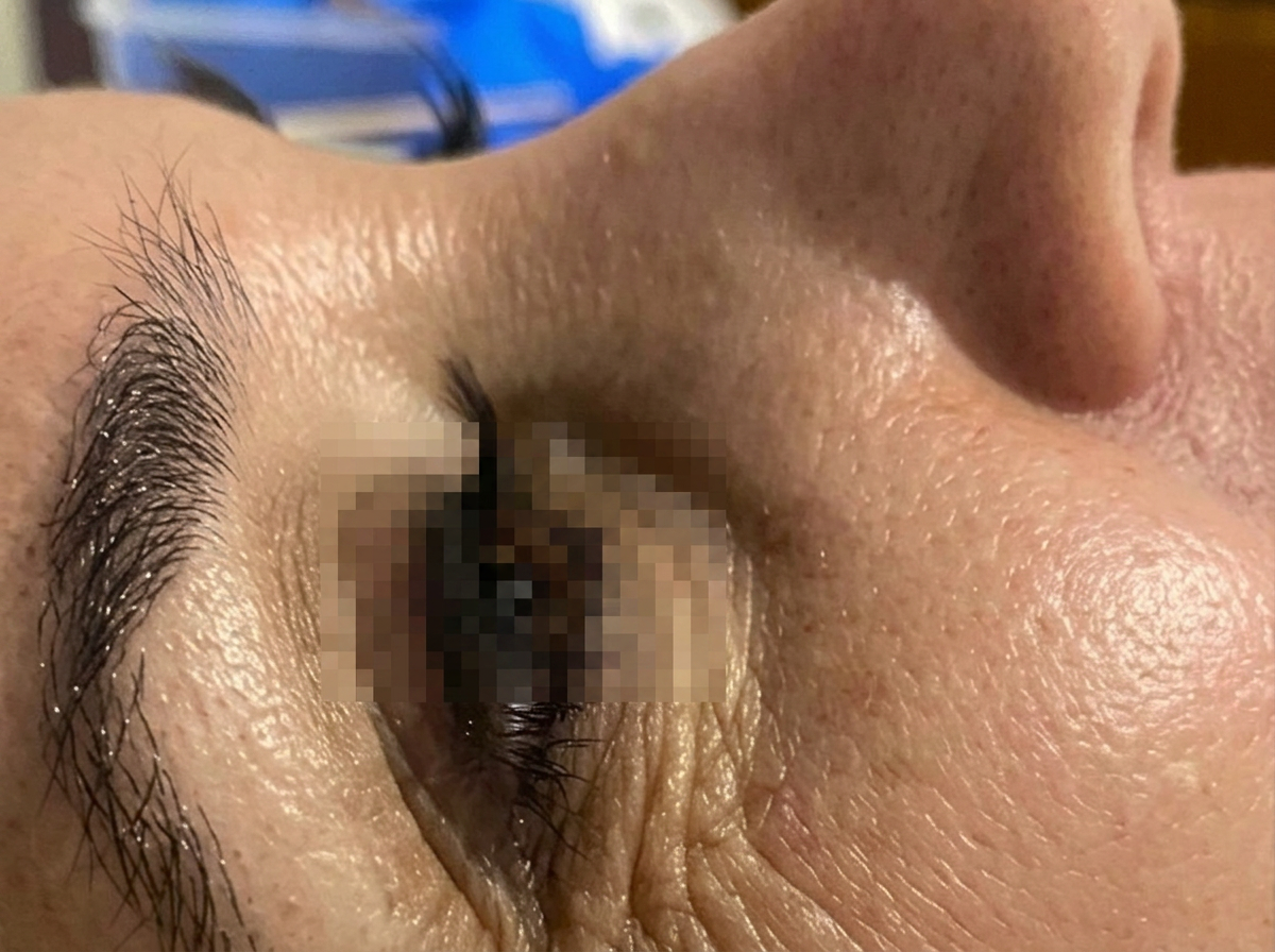 Protocolo facial combinado — antes